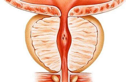 Prostatitas